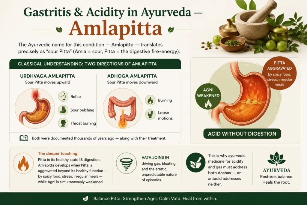 Ayurvedic medical infographic explaining Amlapitta (gastritis and acidity), illustrating Urdhvaga Amlapitta (acid reflux) and Adhoga Amlapitta, along with aggravated Pitta, weakened Agni, and Vata imbalance to show the Ayurvedic root cause of hyperacidity, gastritis, acid reflux, gas, and bloating.