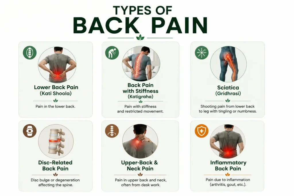 Medical infographic illustrating the major types of back pain in Ayurveda, including lower back pain (Kati Shoola), back pain with stiffness (Katigraha), sciatica (Gridhrasi), disc-related back pain, upper back and neck pain, and inflammatory back pain, using simple medical icons and spine-focused visuals to help identify different back pain patterns.