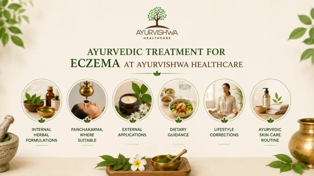 Ayurvishwa Healthcare Ayurvedic eczema treatment illustration featuring internal herbal formulations, Panchakarma, external applications, dietary guidance, lifestyle correction, and Ayurvedic skincare.